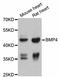 Bone Morphogenetic Protein 4 antibody, STJ22815, St John