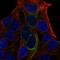 Glucokinase regulatory protein antibody, HPA064305, Atlas Antibodies, Immunofluorescence image 