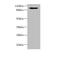 Oligophrenin 1 antibody, LS-C676212, Lifespan Biosciences, Western Blot image 