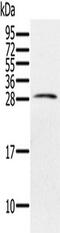 Paired Immunoglobin Like Type 2 Receptor Beta antibody, TA350284, Origene, Western Blot image 