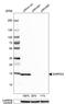 Small Nuclear Ribonucleoprotein D3 Polypeptide antibody, HPA001170, Atlas Antibodies, Western Blot image 