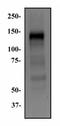 Fibroblast Growth Factor Receptor 1 antibody, NB120-829, Novus Biologicals, Western Blot image 