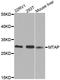 S-methyl-5 -thioadenosine phosphorylase antibody, orb129697, Biorbyt, Western Blot image 