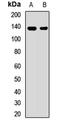 Solute Carrier Family 4 Member 2 antibody, LS-C667707, Lifespan Biosciences, Western Blot image 