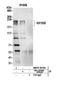 Kinesin Family Member 20B antibody, NBP2-59106, Novus Biologicals, Western Blot image 