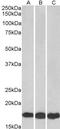 Ubiquitin Conjugating Enzyme E2 L3 antibody, GTX89721, GeneTex, Western Blot image 