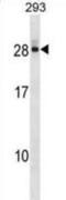 DCMP Deaminase antibody, abx028967, Abbexa, Western Blot image 