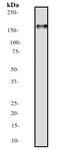 Platelet Derived Growth Factor Receptor Beta antibody, ab32570, Abcam, Western Blot image 