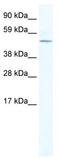 Ceramide Synthase 4 antibody, TA329934, Origene, Western Blot image 