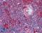 LCK Proto-Oncogene, Src Family Tyrosine Kinase antibody, LS-B2049, Lifespan Biosciences, Immunohistochemistry paraffin image 