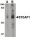 STEAP Family Member 1 antibody, PA5-20404, Invitrogen Antibodies, Western Blot image 
