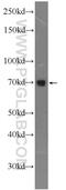 Adaptor Related Protein Complex 1 Subunit Gamma 2 antibody, 17907-1-AP, Proteintech Group, Western Blot image 