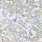 Peroxisomal Biogenesis Factor 3 antibody, LS-C349077, Lifespan Biosciences, Immunohistochemistry paraffin image 