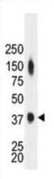 Creatine Kinase, M-Type antibody, abx033159, Abbexa, Western Blot image 