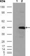 Betaine--Homocysteine S-Methyltransferase antibody, GTX83111, GeneTex, Western Blot image 