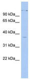 Paired Box 4 antibody, TA331133, Origene, Western Blot image 