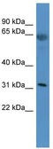 Olfactory Receptor Family 2 Subfamily T Member 29 antibody, TA342753, Origene, Western Blot image 