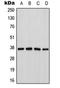 Cathepsin H antibody, LS-C353958, Lifespan Biosciences, Western Blot image 