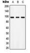 AXL Receptor Tyrosine Kinase antibody, MBS821736, MyBioSource, Western Blot image 