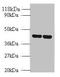 Arginine Vasopressin Receptor 1B antibody, LS-C285749, Lifespan Biosciences, Western Blot image 