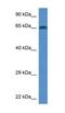 TATA-Box Binding Protein Associated Factor 6 Like antibody, NBP1-74133, Novus Biologicals, Western Blot image 