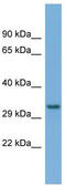 Phosphatidate cytidylyltransferase, mitochondrial antibody, TA342494, Origene, Western Blot image 