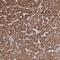 Proteasome 26S Subunit, Non-ATPase 6 antibody, NBP2-32677, Novus Biologicals, Immunohistochemistry frozen image 