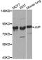 Junction Plakoglobin antibody, STJ24277, St John