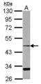 C-C Motif Chemokine Receptor Like 2 antibody, NBP2-15769, Novus Biologicals, Western Blot image 