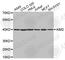 Absent In Melanoma 2 antibody, A3356, ABclonal Technology, Western Blot image 