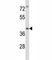 Interleukin 1 Receptor Associated Kinase 4 antibody, F43563-0.4ML, NSJ Bioreagents, Western Blot image 