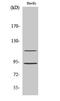 Cyclin Dependent Kinase 11B antibody, A11584-1, Boster Biological Technology, Western Blot image 