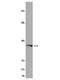 G Protein Subunit Alpha I1 antibody, NBP2-29768, Novus Biologicals, Western Blot image 