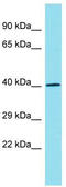 Repulsive Guidance Molecule BMP Co-Receptor A antibody, TA338026, Origene, Western Blot image 