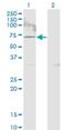 Acyl-CoA Synthetase Short Chain Family Member 2 antibody, H00055902-M09, Novus Biologicals, Western Blot image 