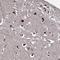 Anoctamin 10 antibody, HPA051569, Atlas Antibodies, Immunohistochemistry frozen image 