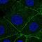 Actin Related Protein 2/3 Complex Subunit 1A antibody, HPA004334, Atlas Antibodies, Immunofluorescence image 