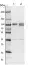 Oxysterol Binding Protein Like 9 antibody, NBP1-85954, Novus Biologicals, Western Blot image 