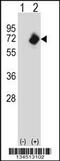 N-Myristoyltransferase 2 antibody, 57-816, ProSci, Western Blot image 