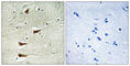Mitogen-Activated Protein Kinase Kinase Kinase 10 antibody, abx013570, Abbexa, Western Blot image 