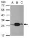 Adenylate Kinase 3 antibody, NBP2-15317, Novus Biologicals, Western Blot image 