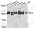 B-Raf Proto-Oncogene, Serine/Threonine Kinase antibody, A2434, ABclonal Technology, Western Blot image 