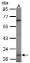 MAGE Family Member A3 antibody, PA5-31142, Invitrogen Antibodies, Western Blot image 