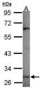 MAGE Family Member A3 antibody, PA5-31142, Invitrogen Antibodies, Western Blot image 