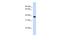 Acyl-CoA Binding Domain Containing 4 antibody, A15097, Boster Biological Technology, Western Blot image 