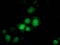 Phenylethanolamine N-methyltransferase antibody, LS-C172928, Lifespan Biosciences, Immunofluorescence image 