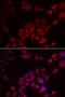 Phosphoinositide Kinase, FYVE-Type Zinc Finger Containing antibody, LS-C334877, Lifespan Biosciences, Immunofluorescence image 