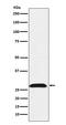 Rho GDP Dissociation Inhibitor Alpha antibody, M03135-2, Boster Biological Technology, Western Blot image 