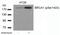 BRCA1 DNA Repair Associated antibody, GTX50272, GeneTex, Western Blot image 