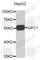 Glypican 1 antibody, A3894, ABclonal Technology, Western Blot image 